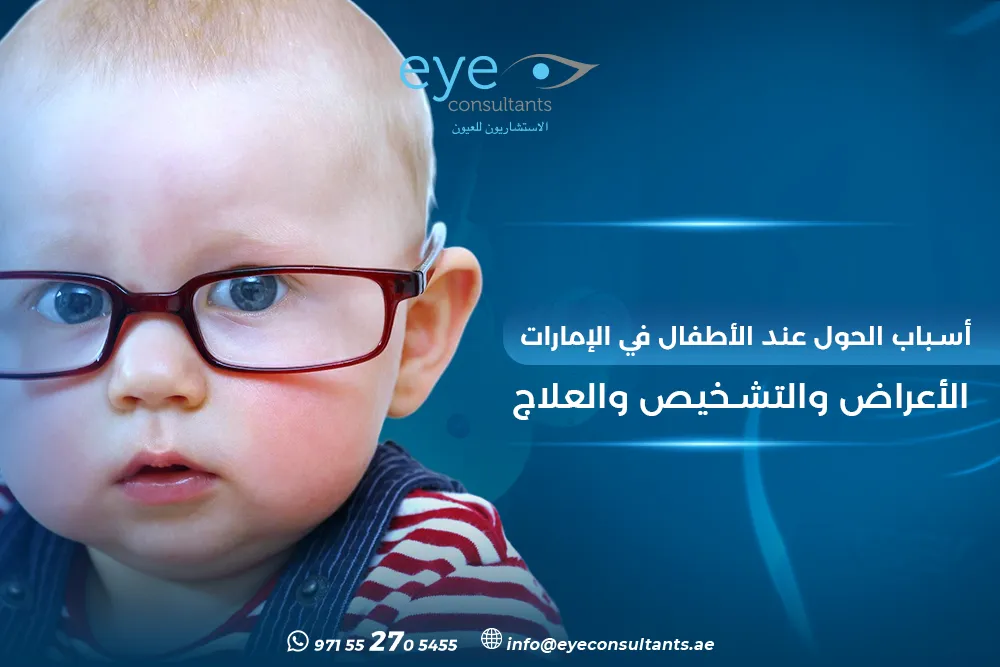 أسباب الحول عند الأطفال الإمارات