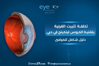 تكلفة تثبيت القرنية بالكروس لينكينج دبي