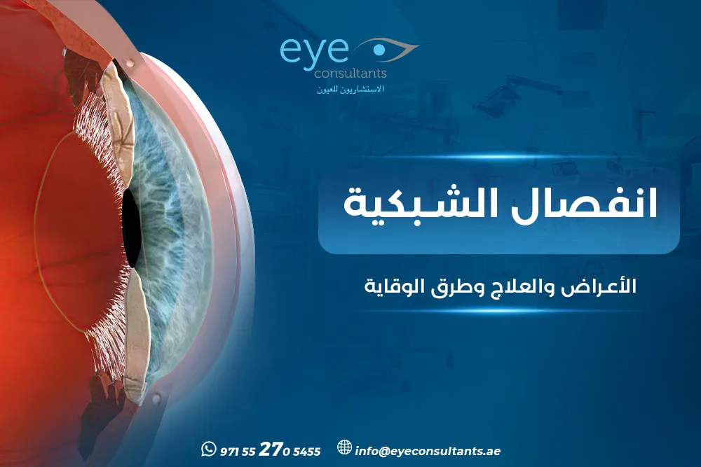 انفصال الشبكية