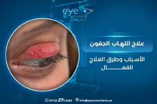 علاج التهاب الجفون