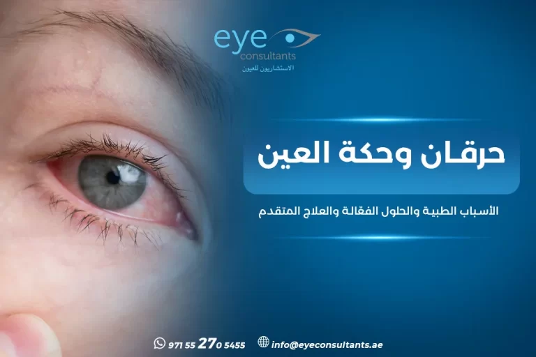 حرقان وحكة العين