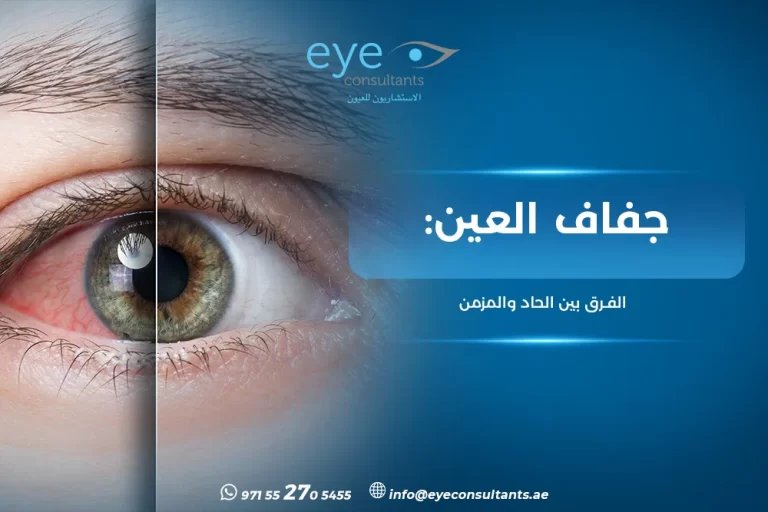 حساسية العين الشائعة