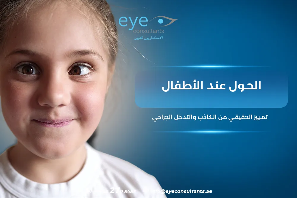 انواع الحول عند الاطفال