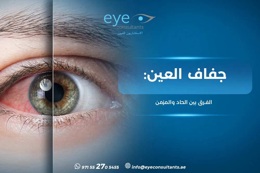 حساسية العين الشائعة